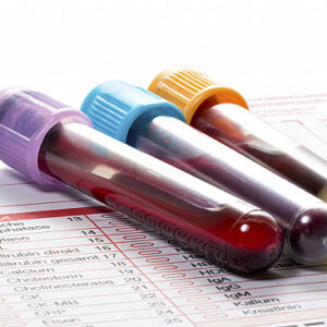 Lab Results Review - Priority Review